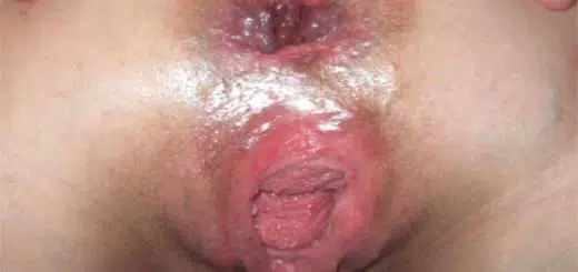 Extreme Rosette ficken