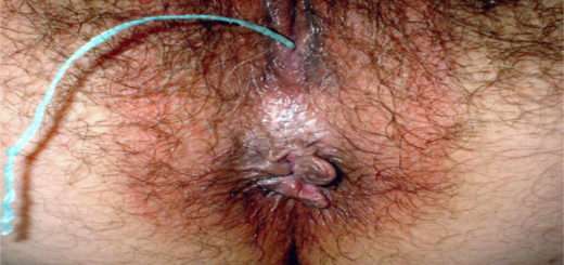 Blutige Muschi poppen suche Fetischdate